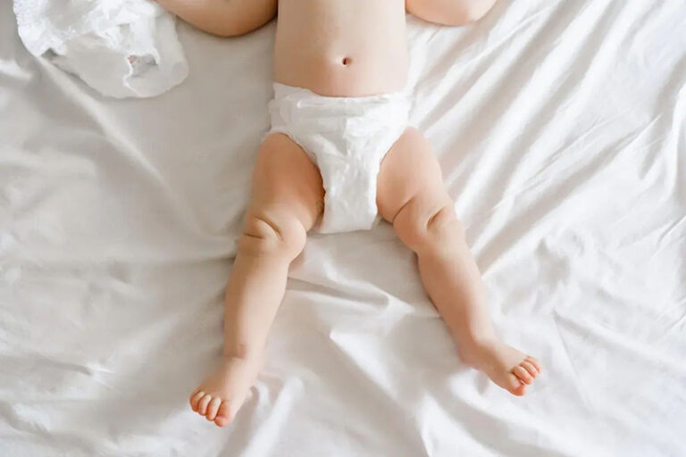 ruam popok bayi